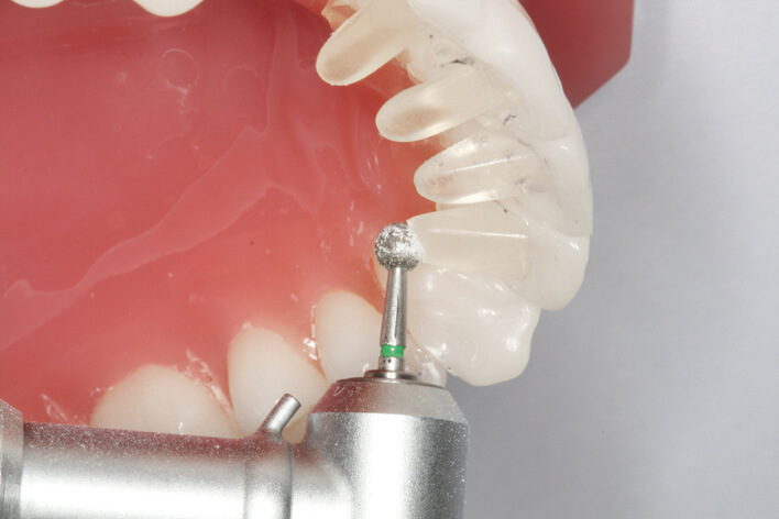 Tiger Mini Mold (mit Orthohalter)