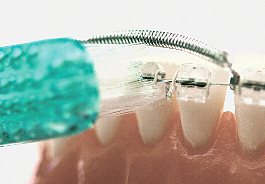 Huckepackfeder Einzelbox F2, rot