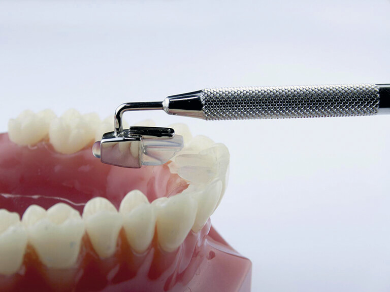 Tiger Mini Mold (mit Orthohalter)