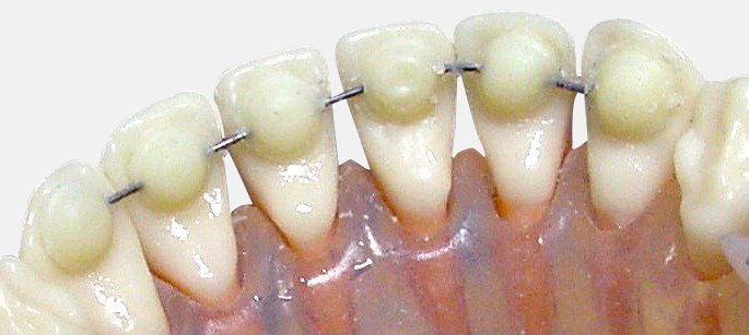 Mini Mold® Starter Kit