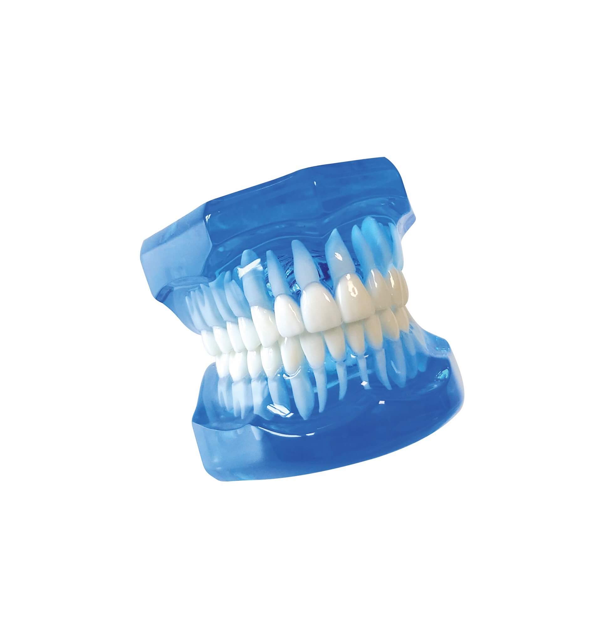 Zahnmodell, blau-transparent